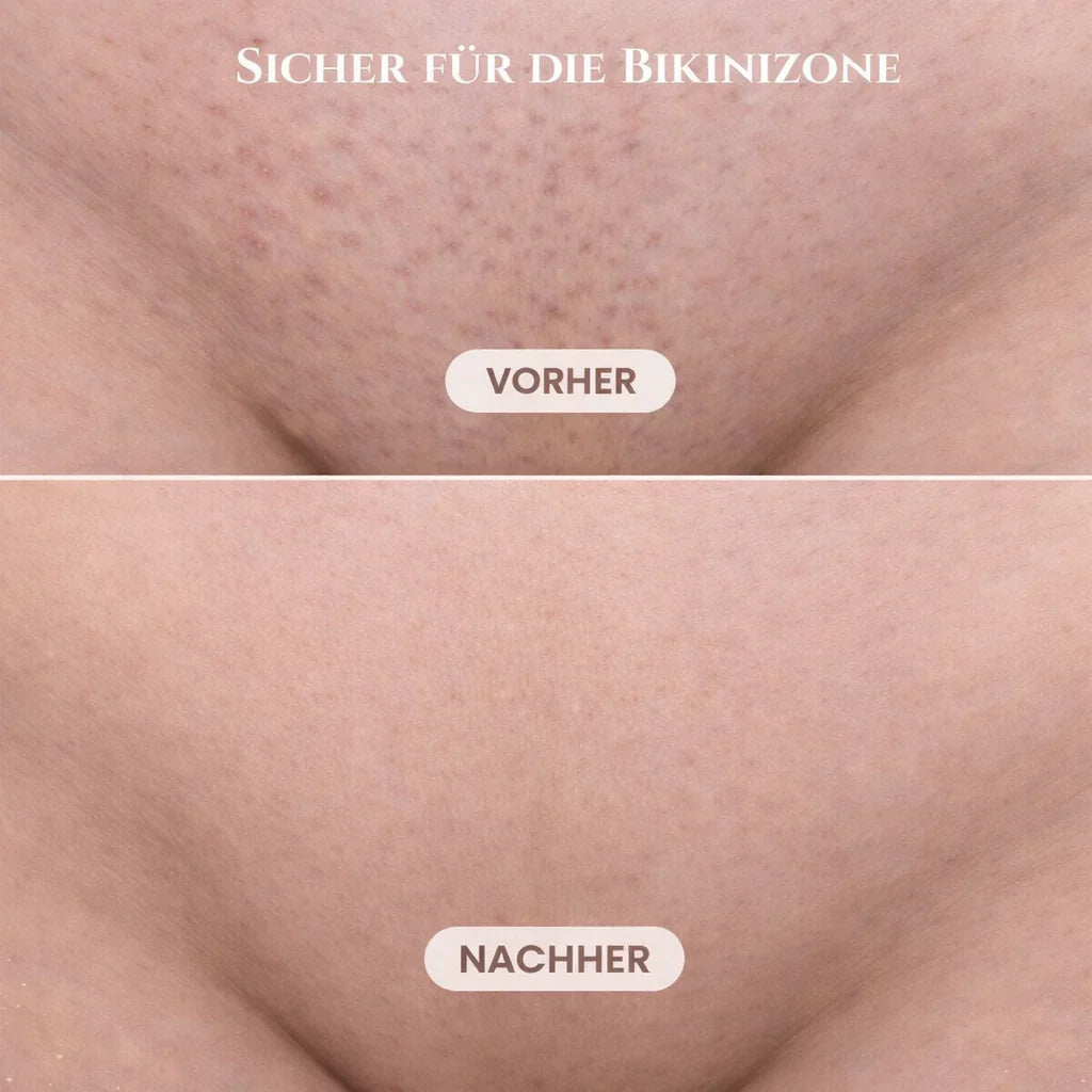 SilkVela™ | Elektrischer Damenrasierer für Intimbereich, Körper und Gesicht